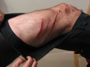 Cycling Leg injury
